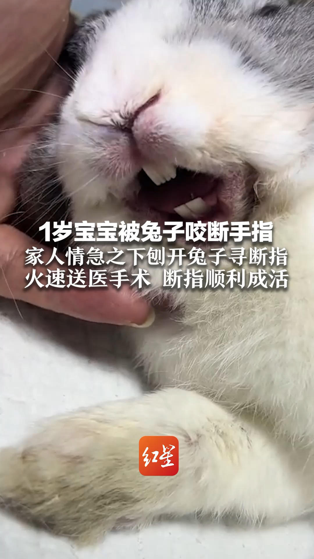 揪心！1岁宝宝被兔子咬断手指 家人情急之下刨开兔子寻断指 火速送医手术 断指顺利成活