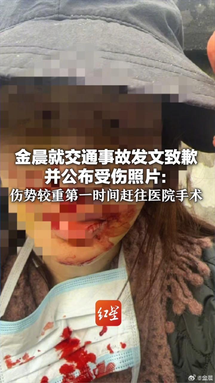 金晨就交通事故发文致歉并公布受伤照片：伤势较重第一时间赶往医院手术 相关赔付由本人全额承担