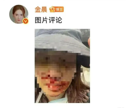 凤凰晚报|车祸顶包，为何能“金晨脱壳”？