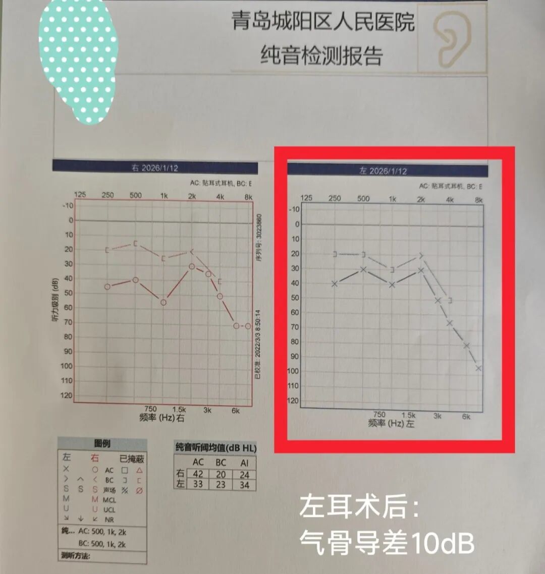 二十年“湿耳”顽疾一朝除，精准手术助老人重获清晰世界