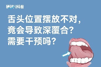 硬核科普：舌头位置摆放不对，竟会导致深覆合？需要干预吗？