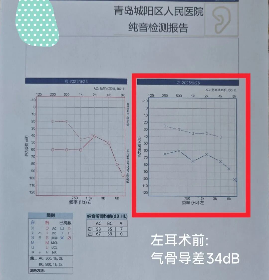 二十年“湿耳”顽疾一朝除，精准手术助老人重获清晰世界