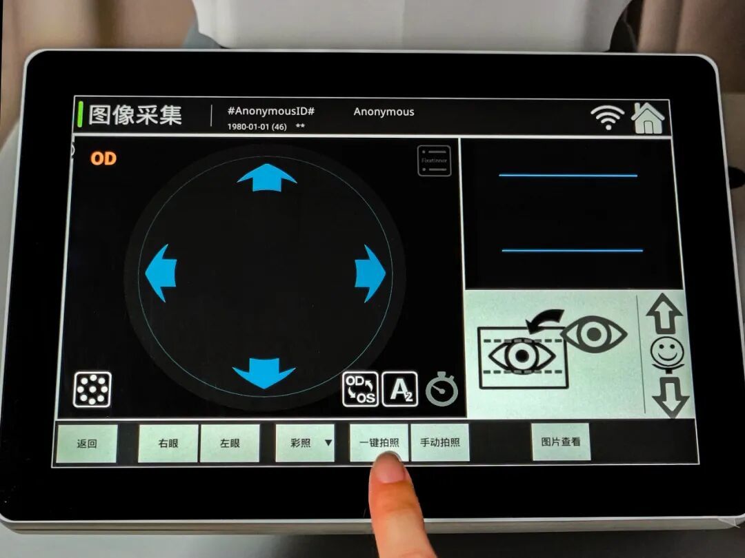 △国产一键式智能化全自动眼底照相机。