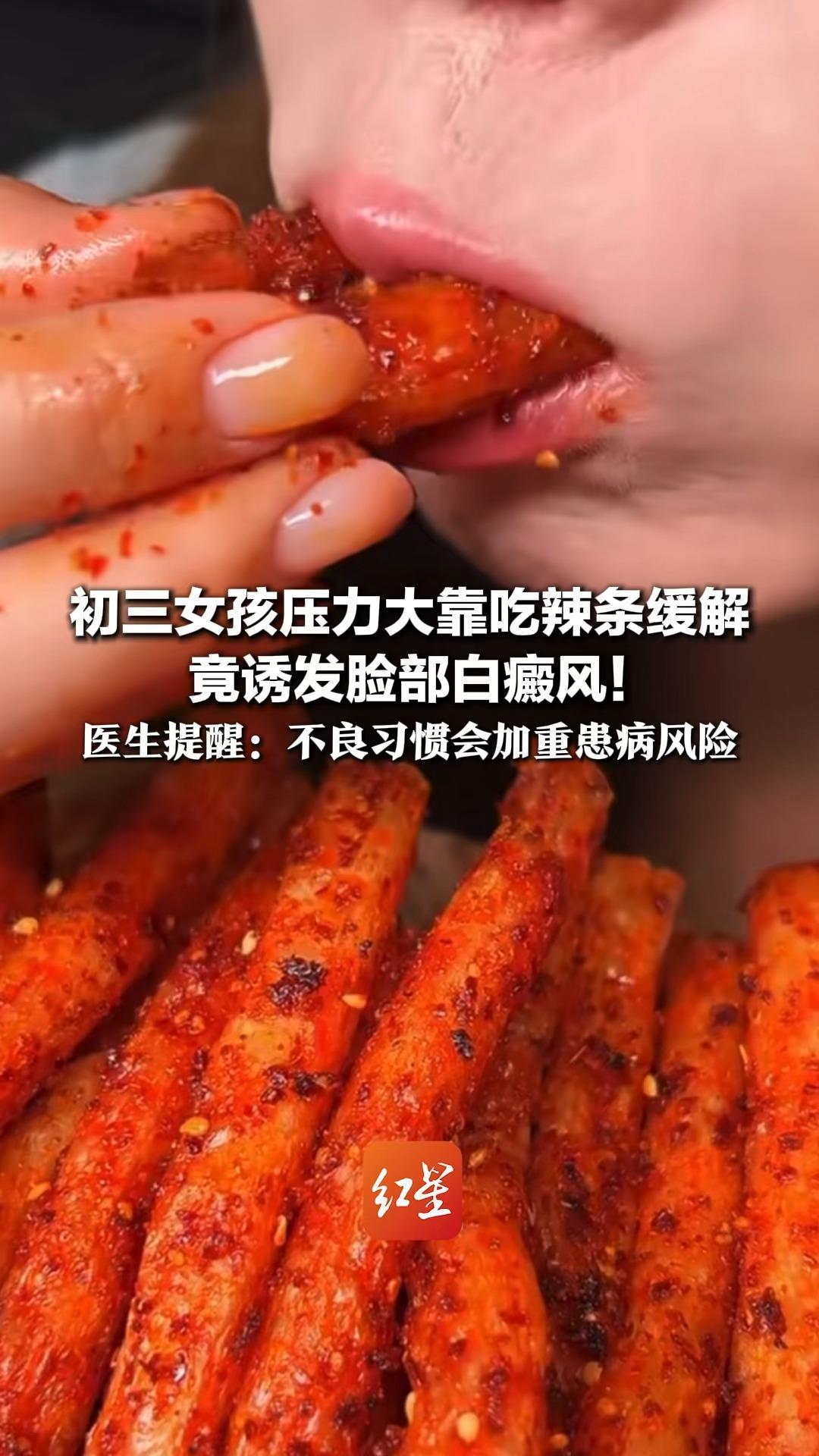 初三女孩压力大靠吃辣条缓解 竟诱发脸部白癜风！“生病后变得很自卑 不爱抬头了”医生提醒：不良习惯会加重患病风险