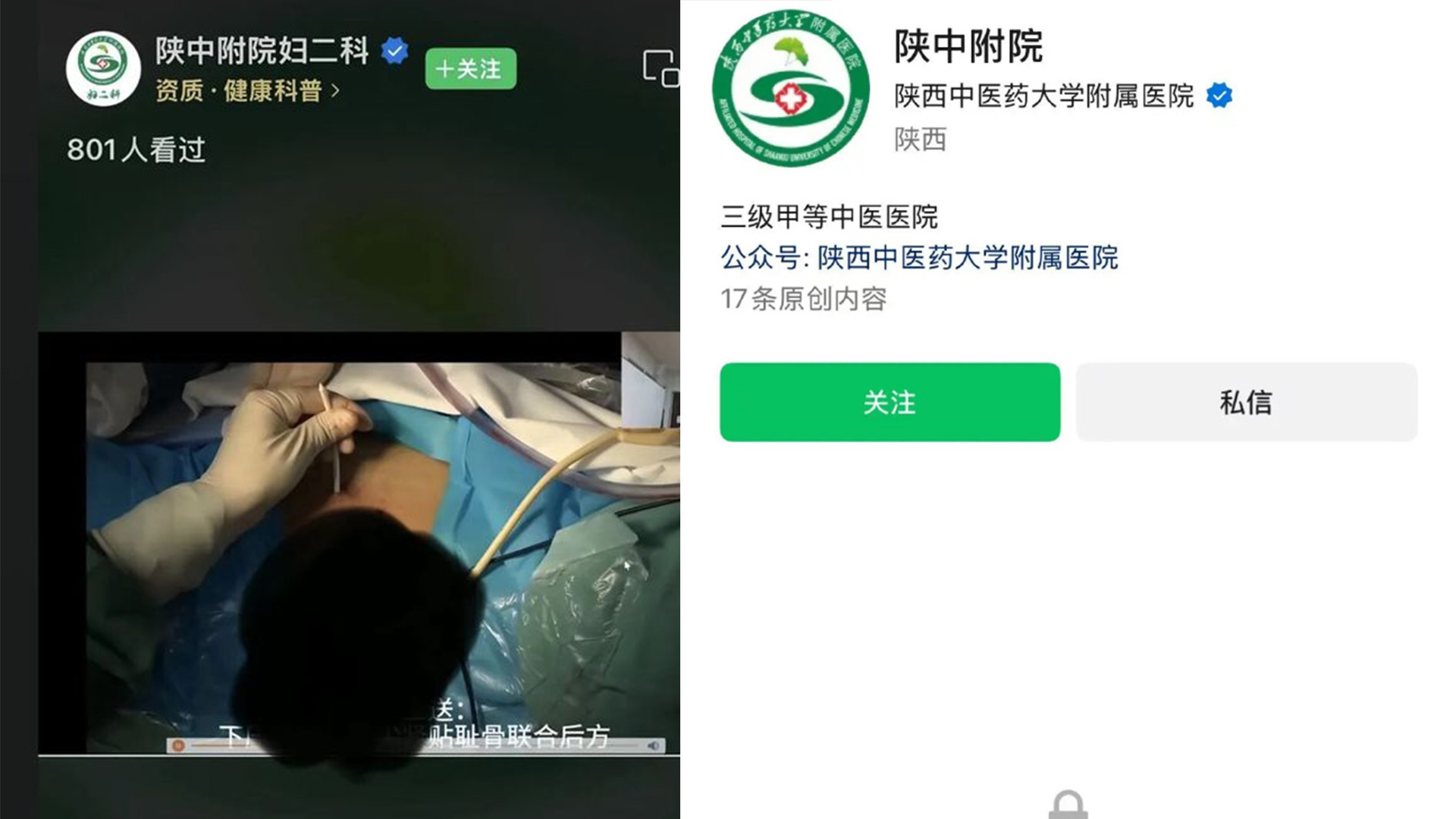 陕中附院妇二科线上直播手术，被指暴露女患者隐私部位，医院回应：系在平台授课，已被叫停，咸阳卫健委已介入核查此事