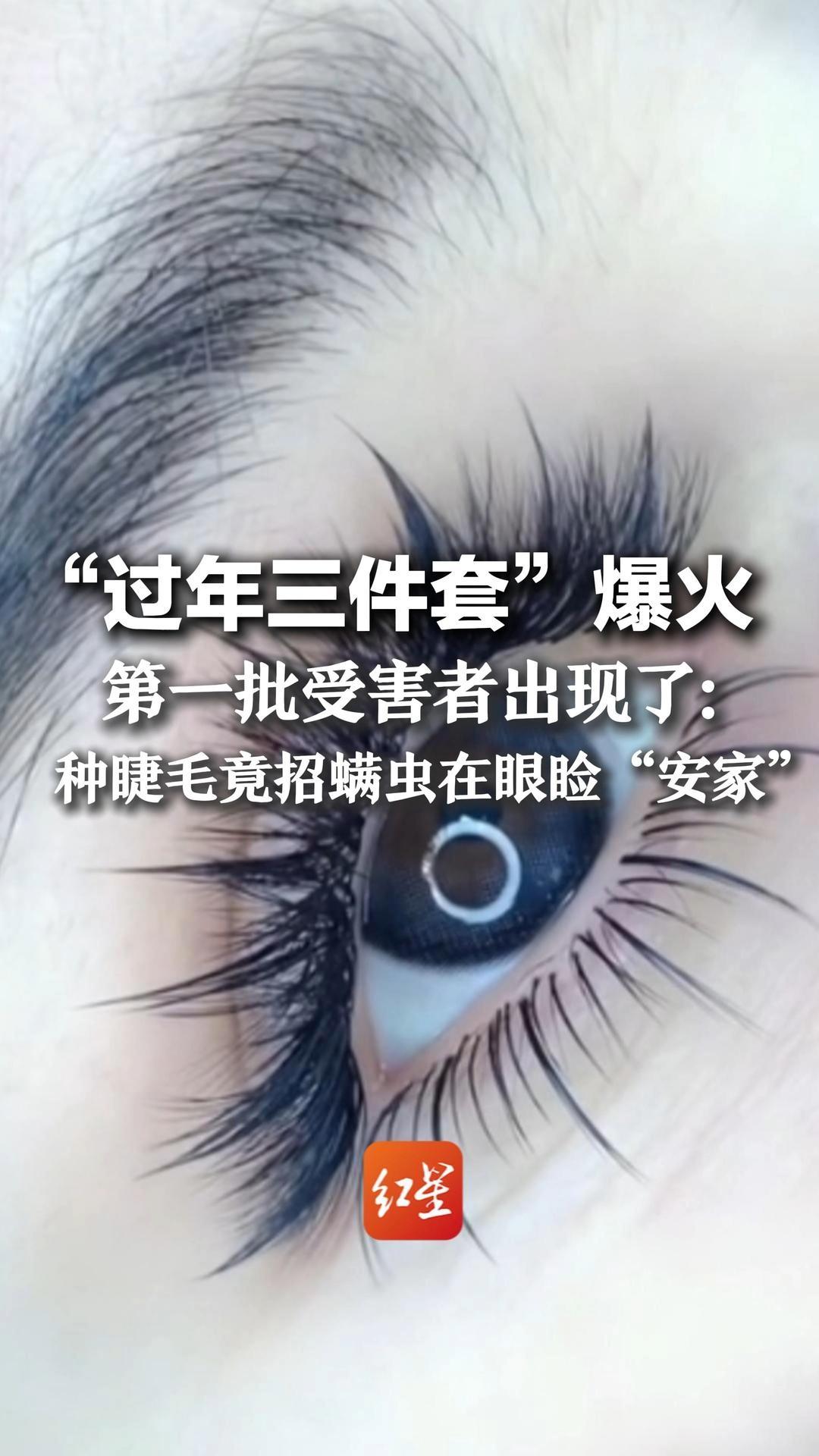“过年三件套”爆火 第一批受害者出现了：种睫毛竟招螨虫在眼睑“安家”医生给出三个防护要点，一定要牢记