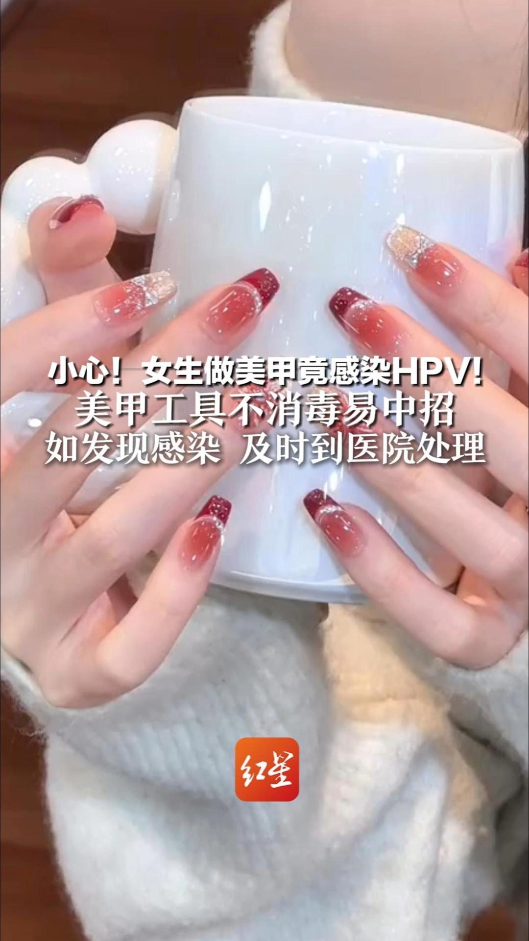 小心！女生做美甲竟感染HPV！美甲工具不消毒易中招 如发现感染 及时到医院处理 务必留意美甲店卫生