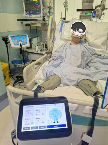（床旁气压治疗预防静脉血栓）