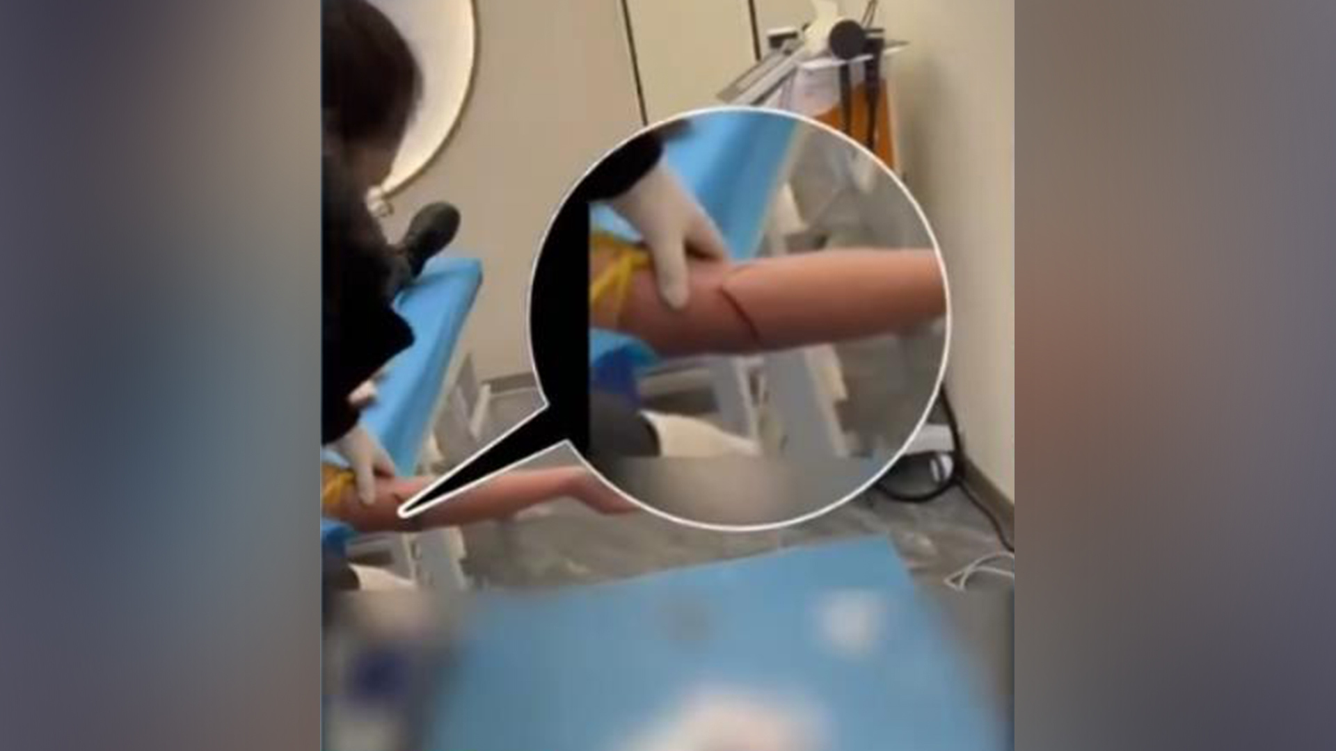 黑诊所无证“放血疗法”牟利，长针刺入皮肤，鲜血直流满地，操作者却说这是在排“邪气”