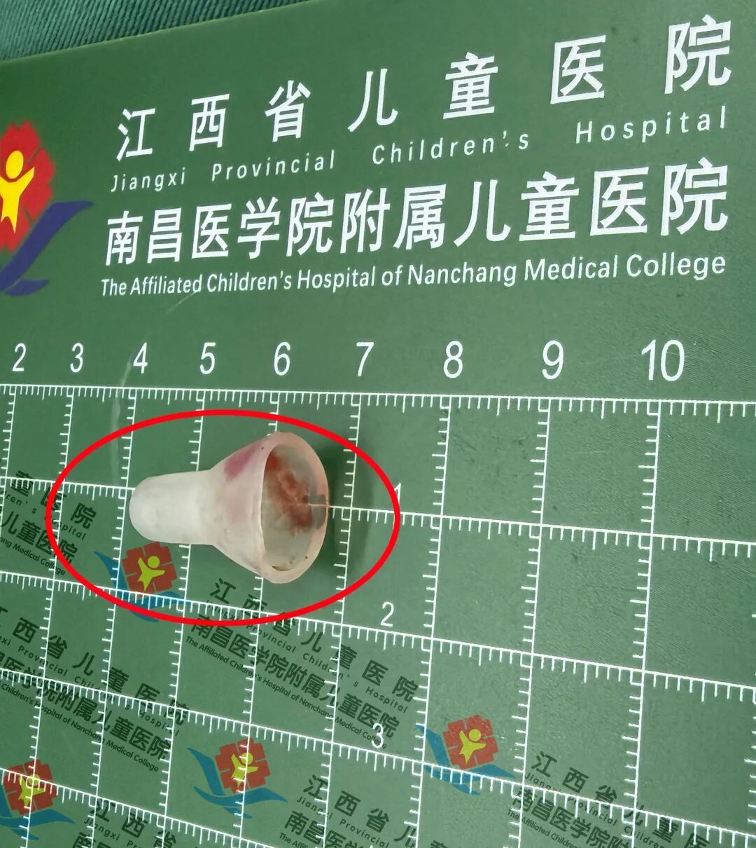 警惕！一个笔帽的“意外”，竟让孩子经历生死10分钟！