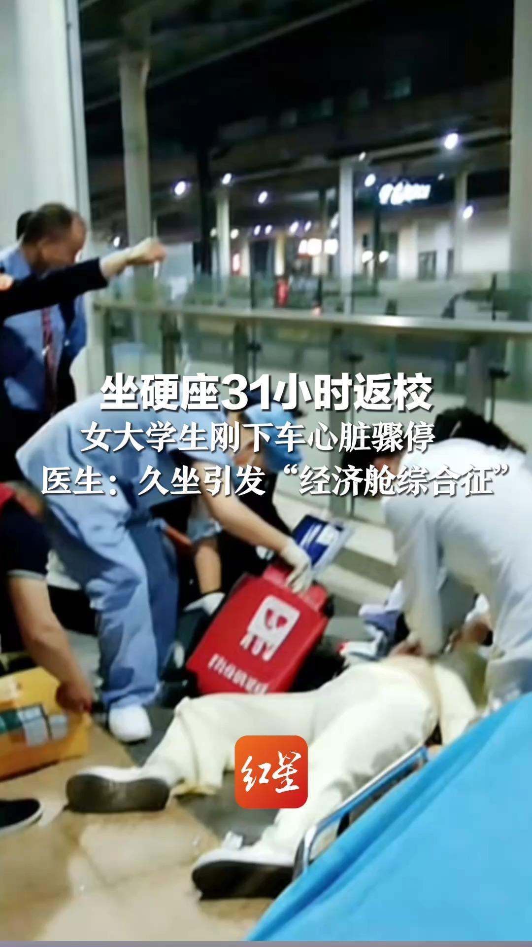 坐硬座31小时返校 女大学生刚下车心脏骤停  经6小时抢救后脱险 医生：久坐引发“经济舱综合征”