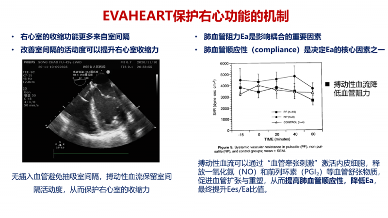 冠军病例｜右心功能不全合并小左室终末期心衰，阜外团队植入LVAD助力新生