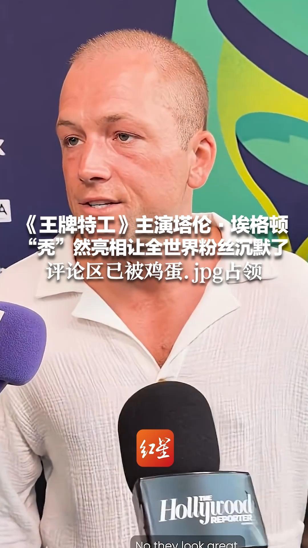 《王牌特工》主演塔伦·埃格顿“秃”然亮相让全世界粉丝沉默了 其发际线后退、头顶发量堪忧 评论区已被鸡蛋.jpg占领