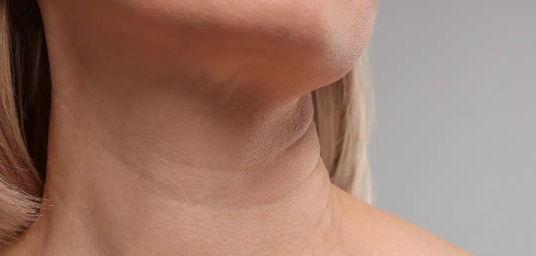 颈部抗衰是一场“持久战”，需要“日常预防”与“专业治疗”双管齐下。