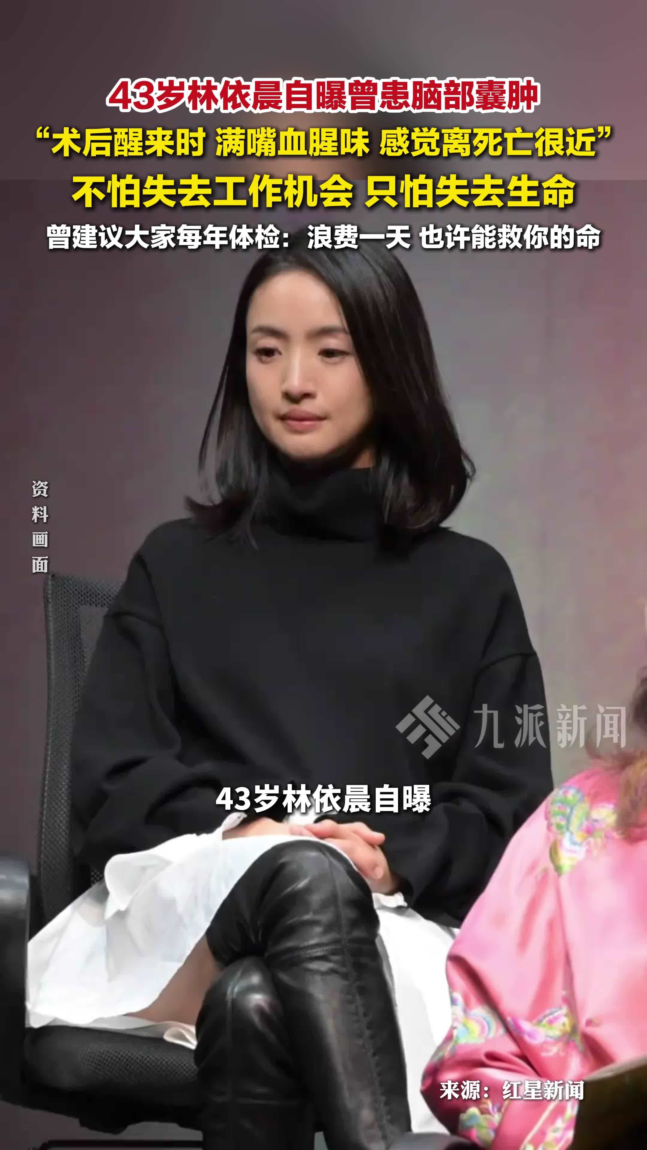 43岁林依晨自曝曾患脑部囊肿：术后满嘴血腥味，感觉离死亡很近