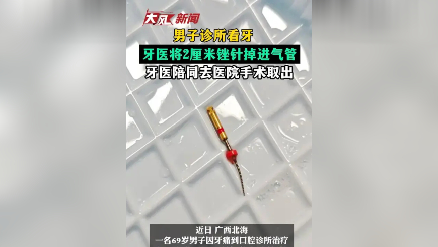 男子诊所看牙牙医将2厘米锉针掉进气管，牙医陪同下去医院手术取出