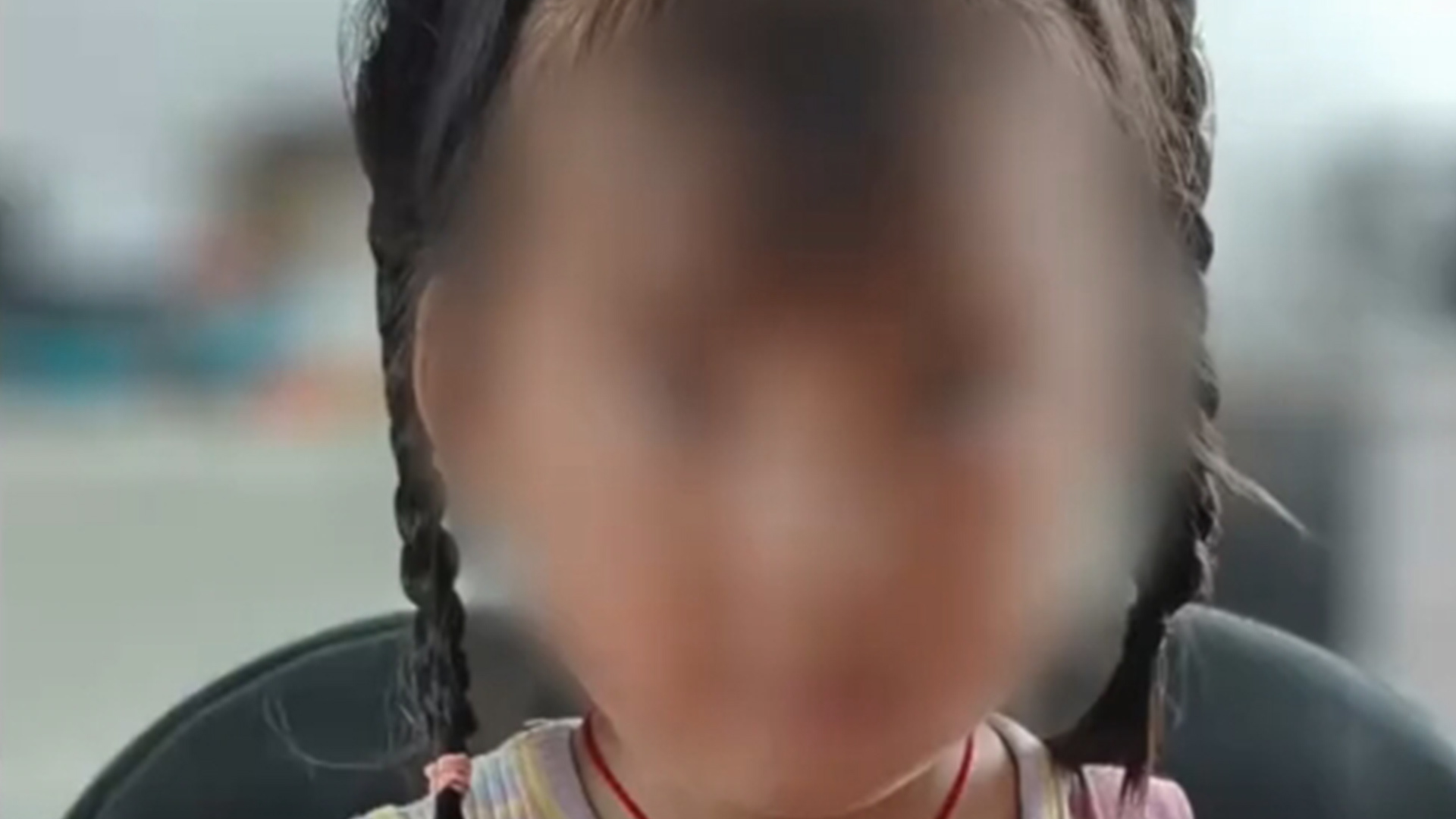 云南5岁女童扁桃体手术出院次日死亡，家长：女儿口鼻喷血，4分钟出血1000ml，医生未告知术中切到动脉，卫生局启动调查