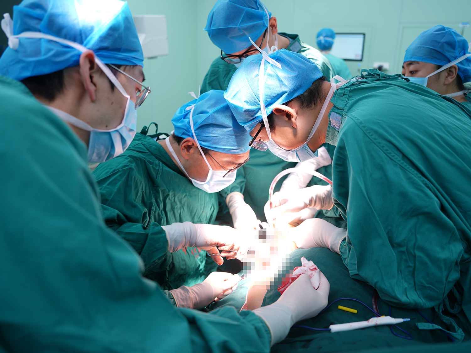 患者遭遇车祸大腿离断失血休克　他们从死神手里抢人