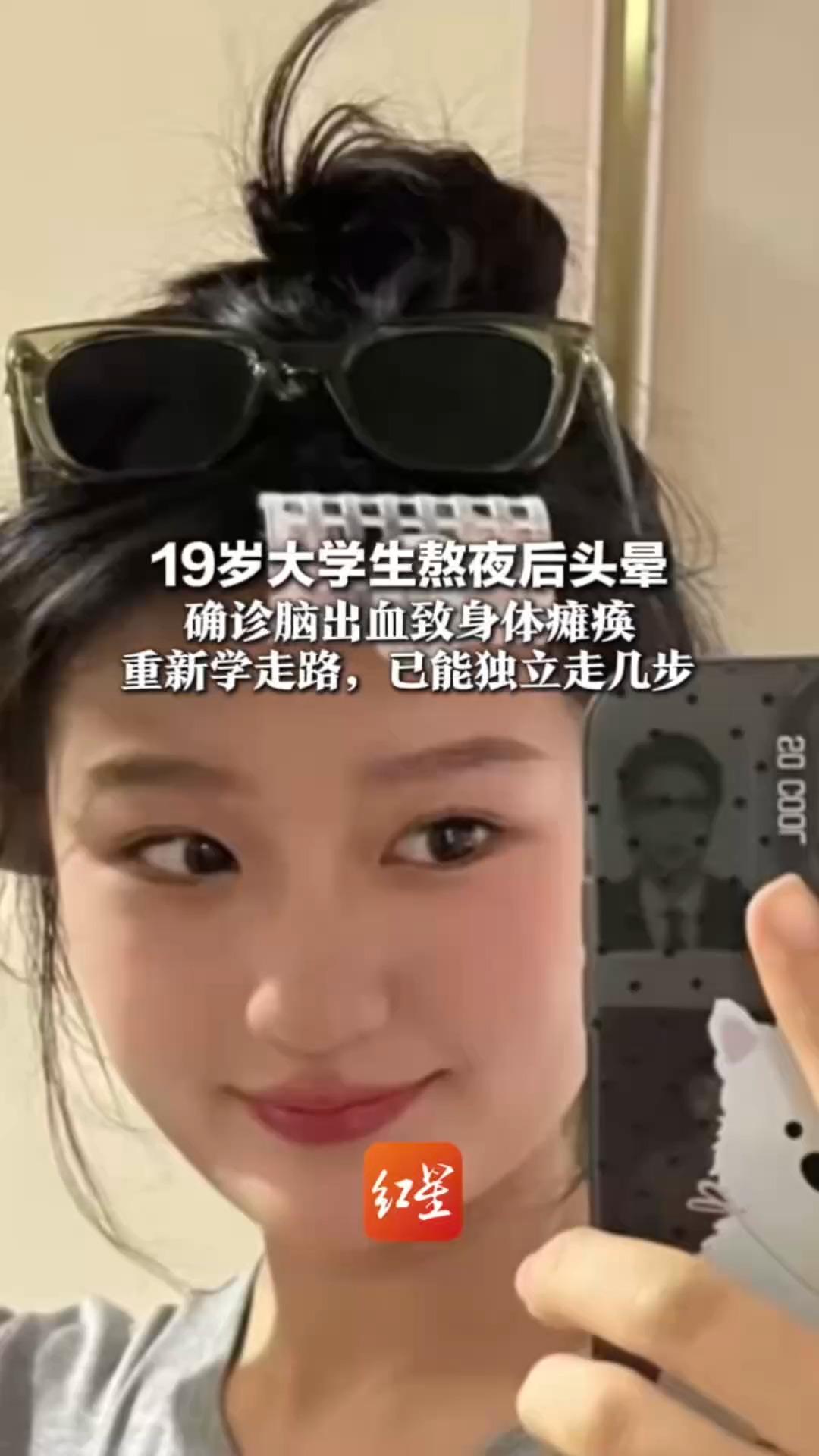 19岁大学生熬夜后头晕 确诊脑出血致身体瘫痪 重新学走路，已能独立走几步 “允许自己脆弱，但绝不认输”