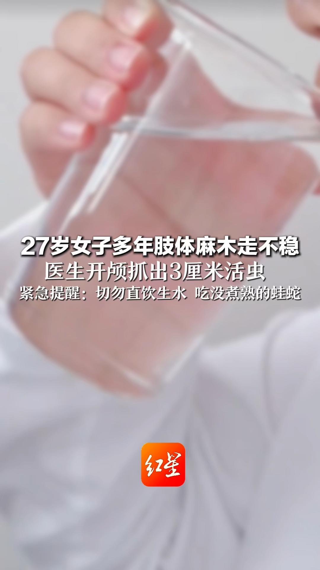 27岁女子多年肢体麻木走不稳 医生开颅抓出3厘米活虫  紧急提醒：切勿直饮生水 吃没煮熟的蛙蛇