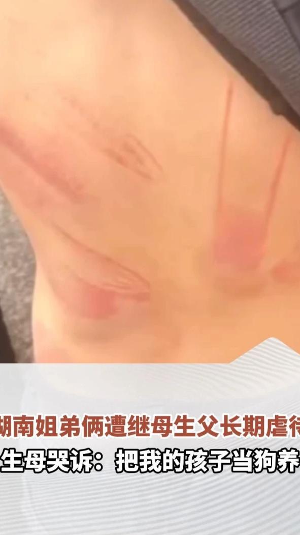 湖南姐弟俩遭继母生父虐待，弟弟被继母逼吃粪便、烫伤下体，姐姐称被继母殴打时父亲就在旁看着。生母哭诉：把我的孩子当狗养