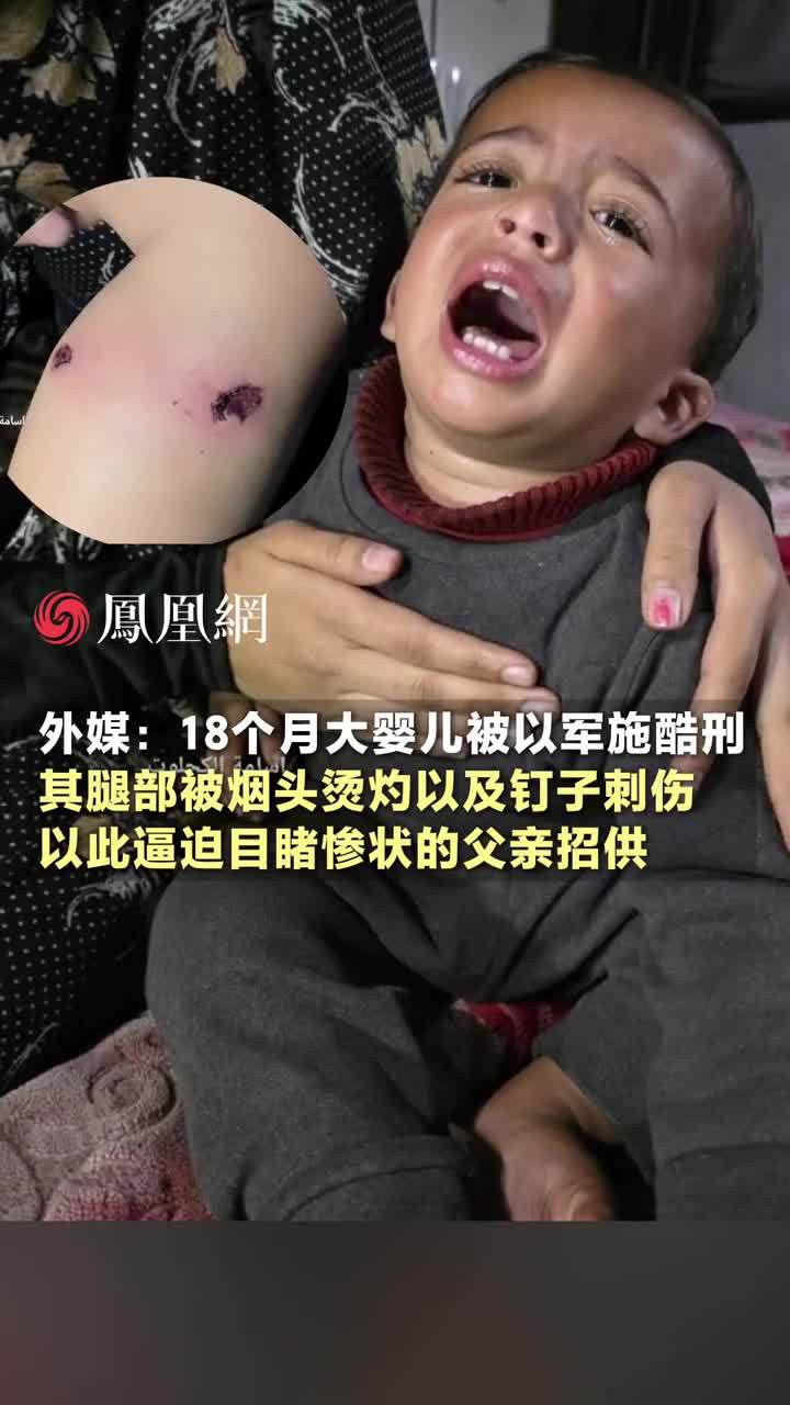 外媒：18个月大婴儿被以军施酷刑，其腿部被烟头烫灼以及钉子刺伤，以此逼迫目睹惨状的父亲招供 #以色列 #巴勒斯坦 #儿童 #国际 #和平
