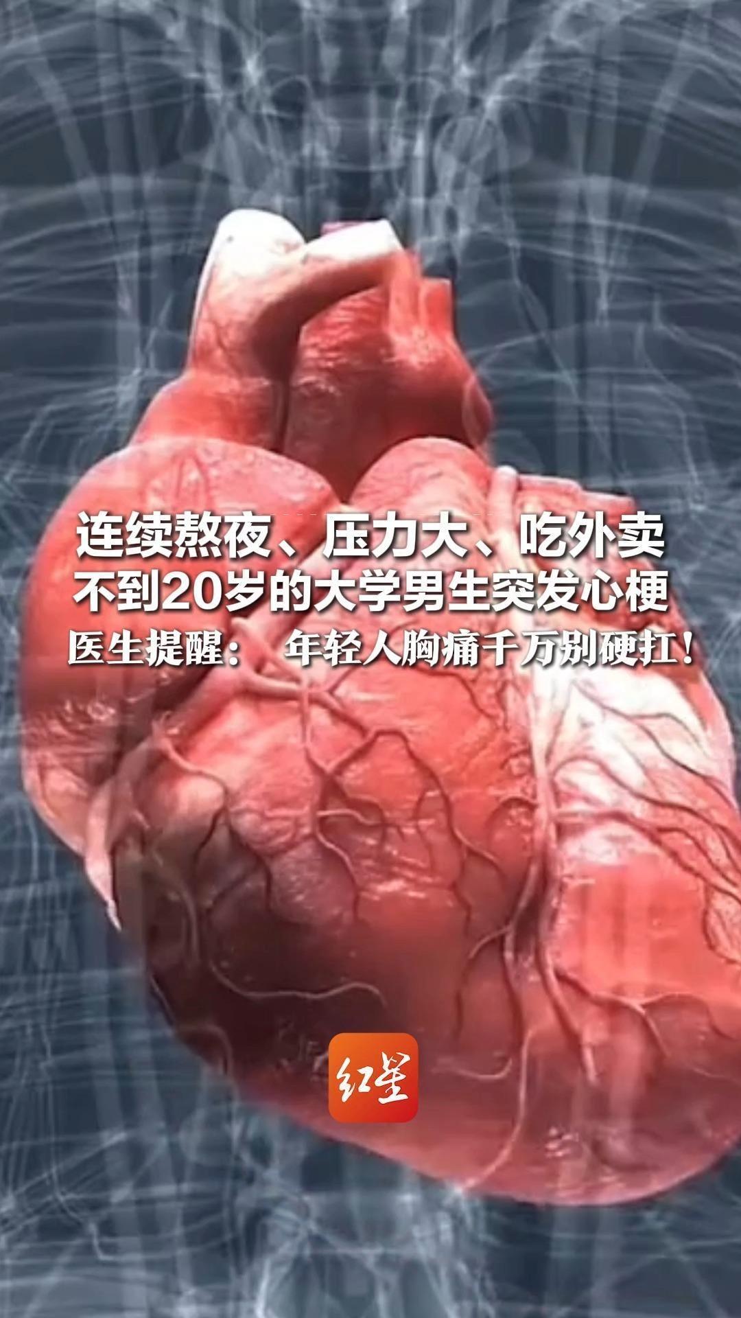 连续熬夜、压力大、吃外卖 不到20岁的大学男生突发心梗 医生提醒：心脏前降支血管病变死亡率高 年轻人胸痛千万别硬扛
