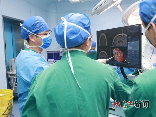 省人民医院的医生正在进行植入式脑机接口手术操作（江西省人民医院供图）