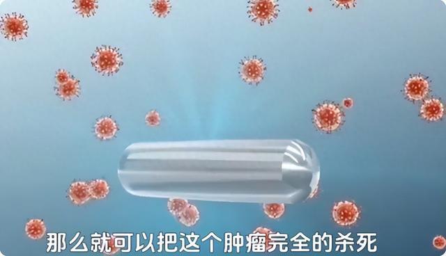 肿瘤“黑科技”碘125：恶果好到爆，为啥大多数病院都不敢碰？