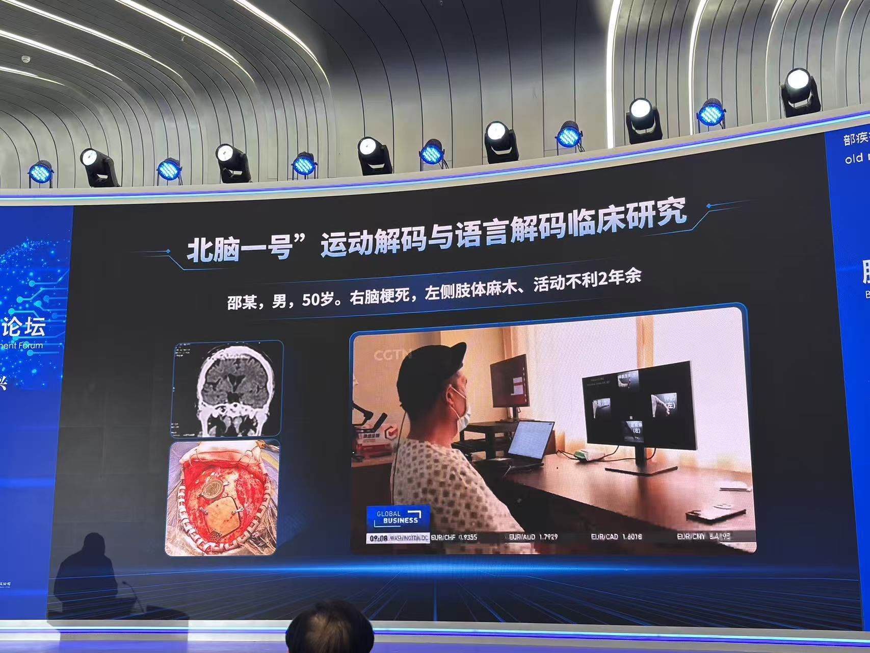 （北脑一号最新进展 记者李明明在2026中关村论坛现场拍摄）