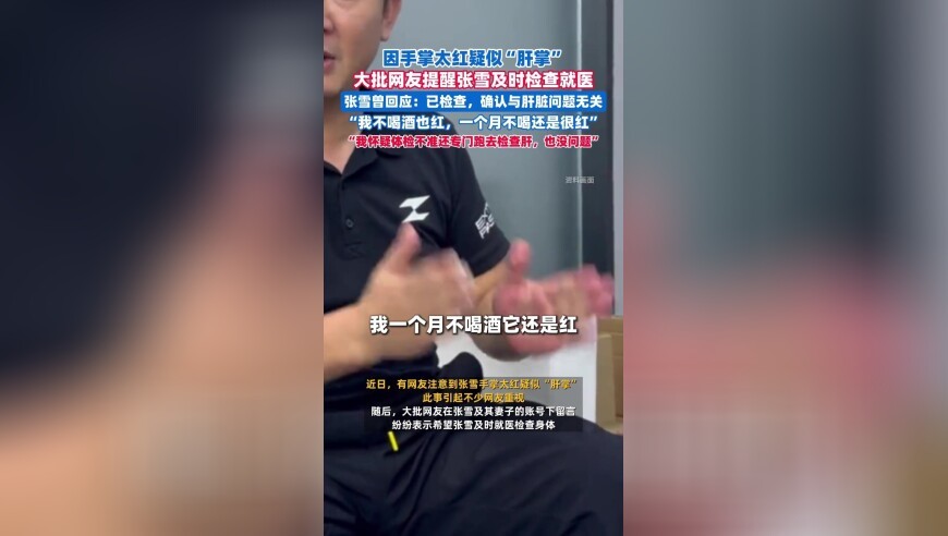 因手掌太红疑似肝掌，大批网友提醒张雪及时就医，张雪回应：已做专项检查，确认与肝脏问题无关