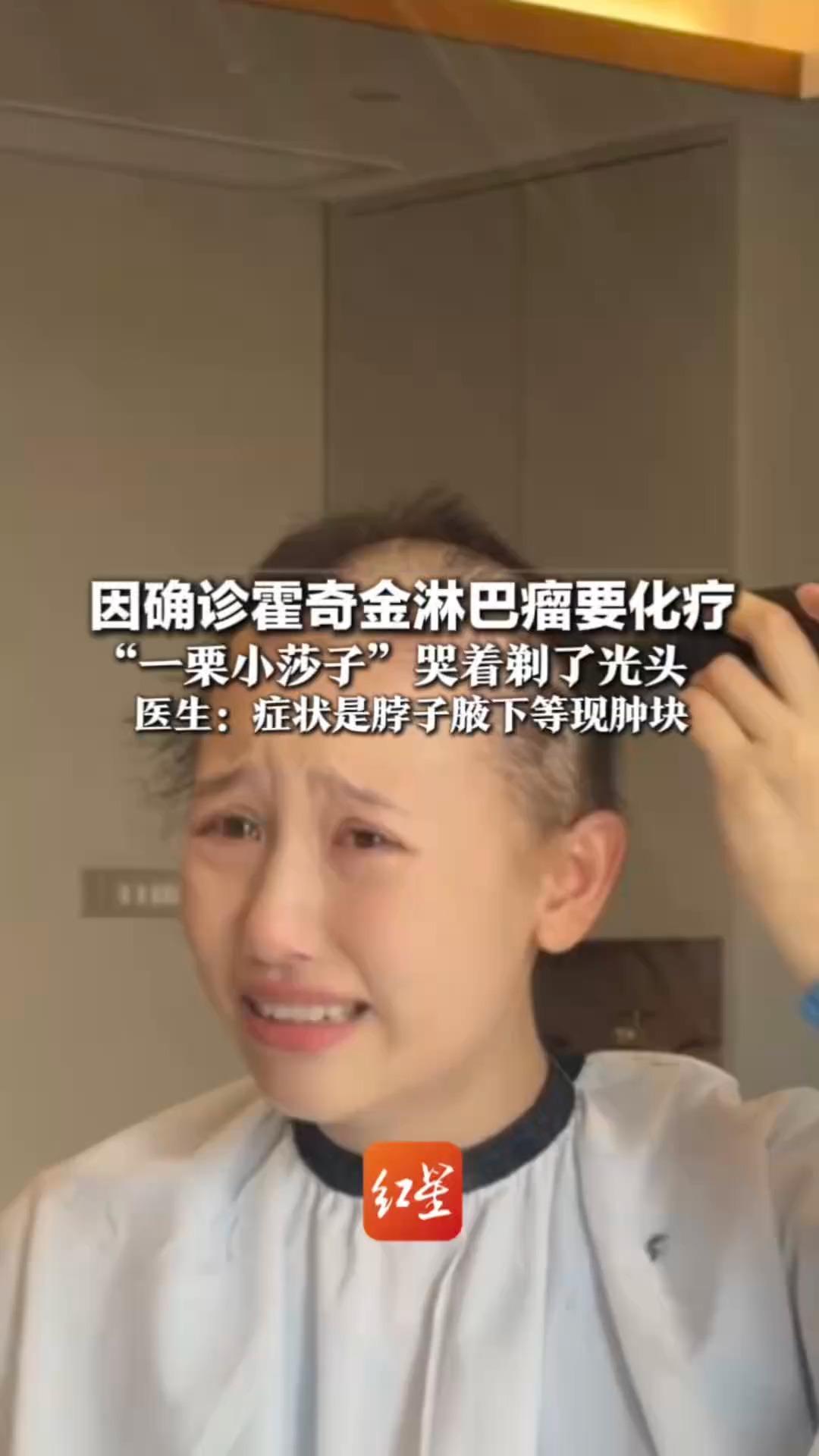 因确诊霍奇金淋巴瘤要化疗“一栗小莎子”哭着剃了光头 医生：症状是脖子腋下等现肿块   恶性度偏低，早期治愈率很高