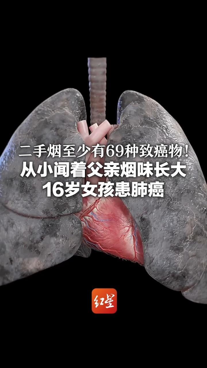 二手烟至少有69种致癌物！从小闻着父亲烟味长大 16岁女孩患肺癌 请让家人远离二手烟三手烟