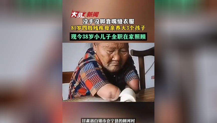 没手没脚靠嘴缝衣服 81岁四肢残疾母亲养大3个孩子 现今38岁小儿子全职在家照顾