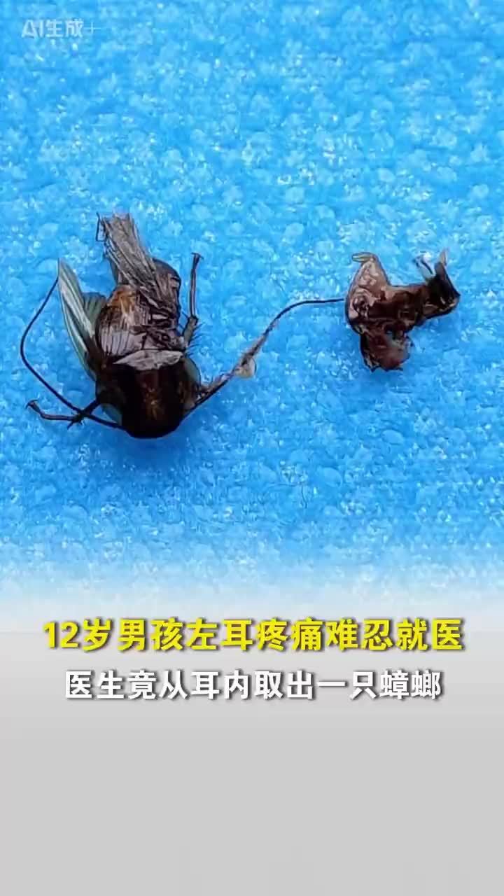 男孩左耳疼痛难忍竟是耳内藏着蟑螂
