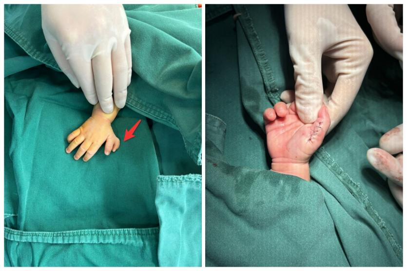 术前术后对比图