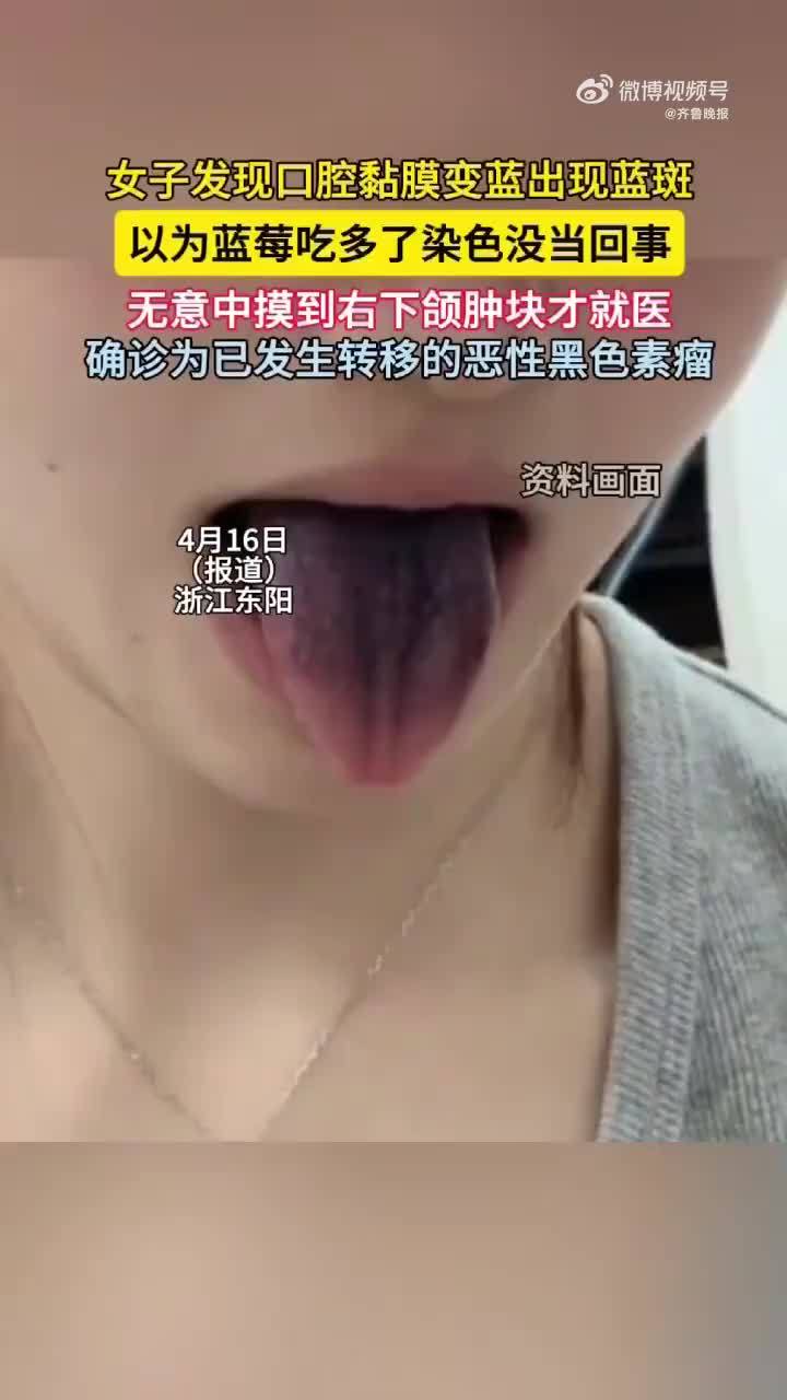 女子以为吃蓝莓嘴染色一查竟是癌