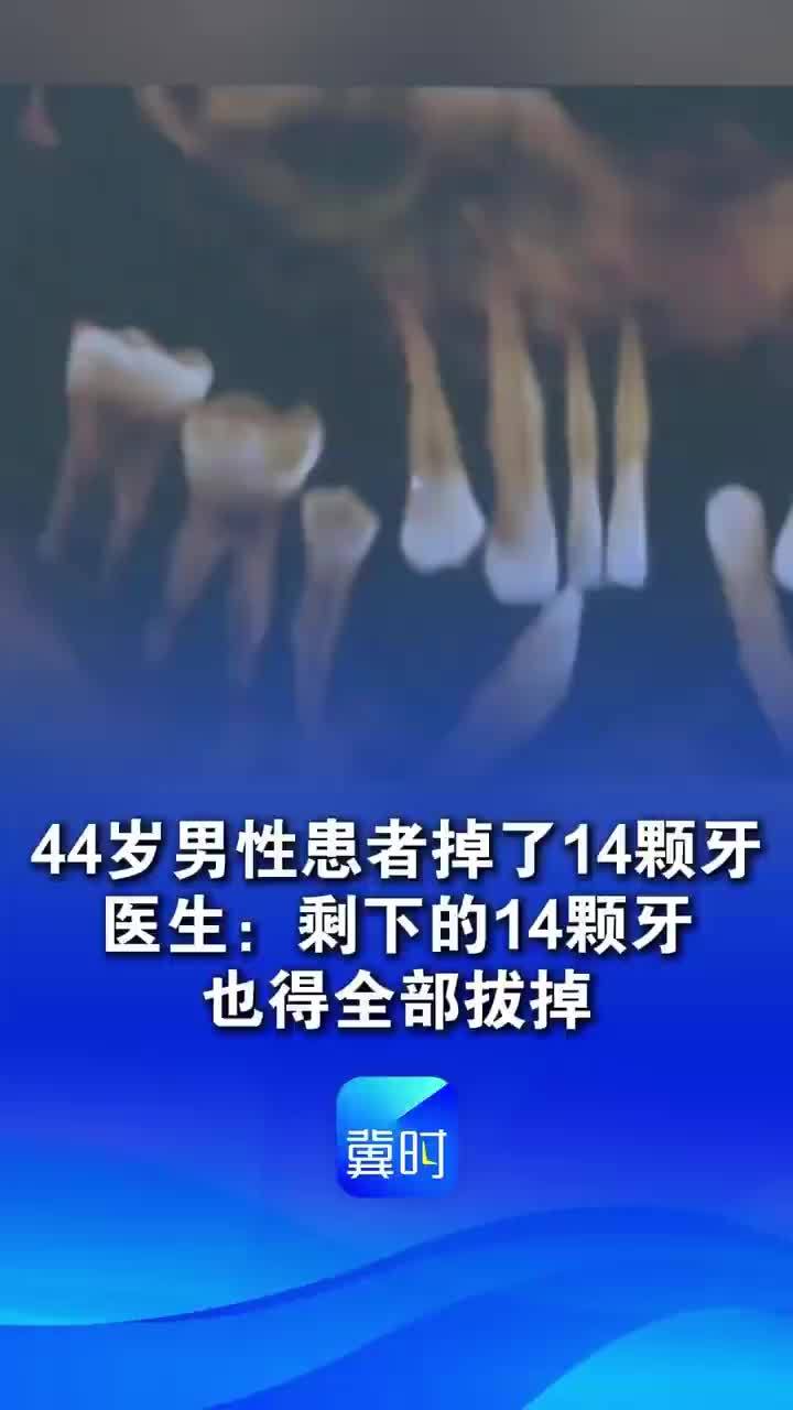 男子掉14颗牙剩下14颗也得全拔掉