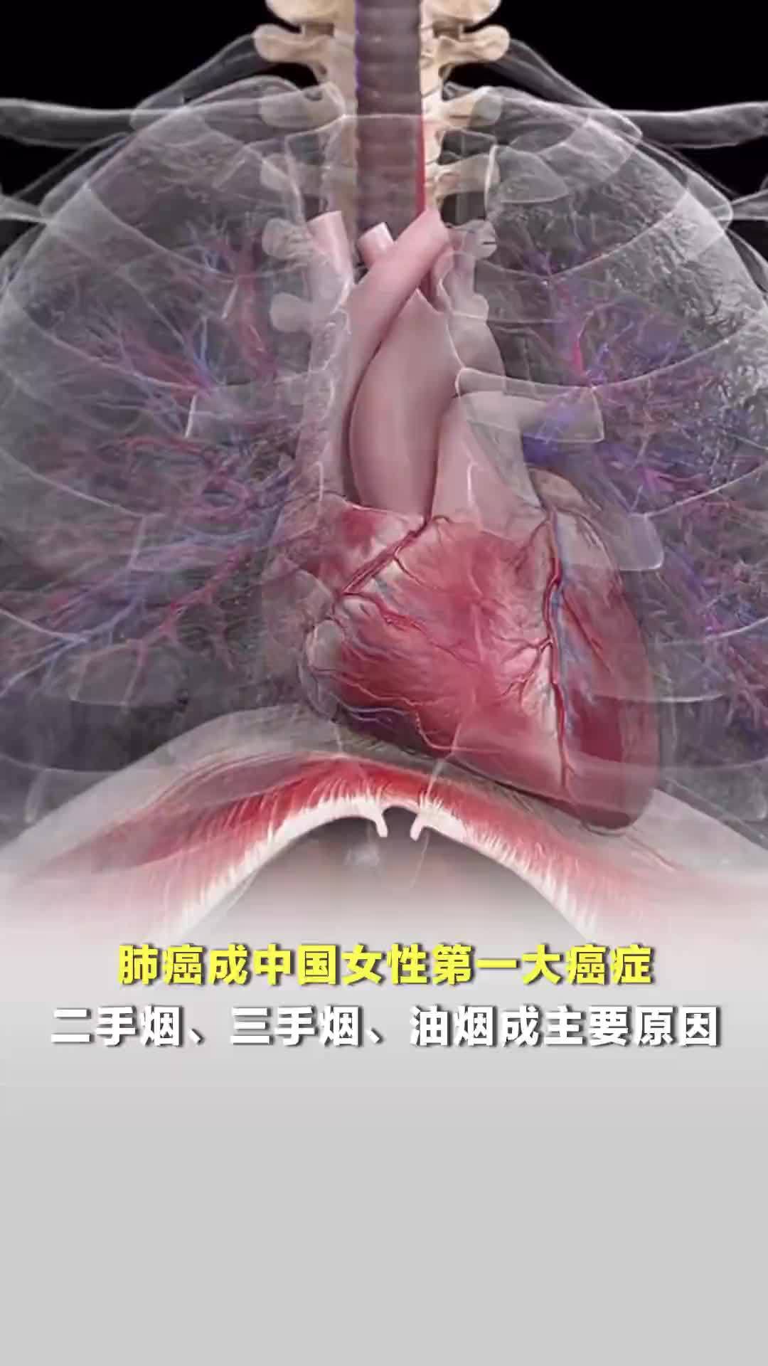 肺癌成中国女性第一大癌症，发病率第二、死亡率第一，二手烟、三手烟、油烟成主要原因