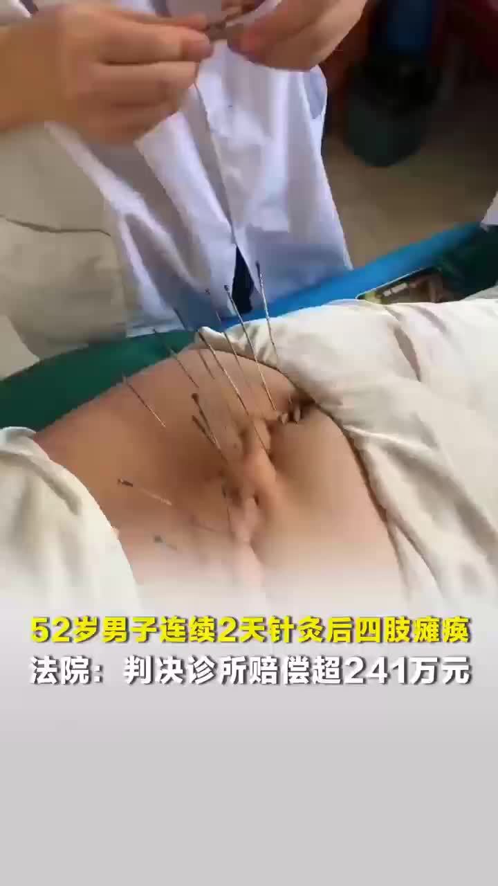 男子连续两天针灸后四肢瘫痪