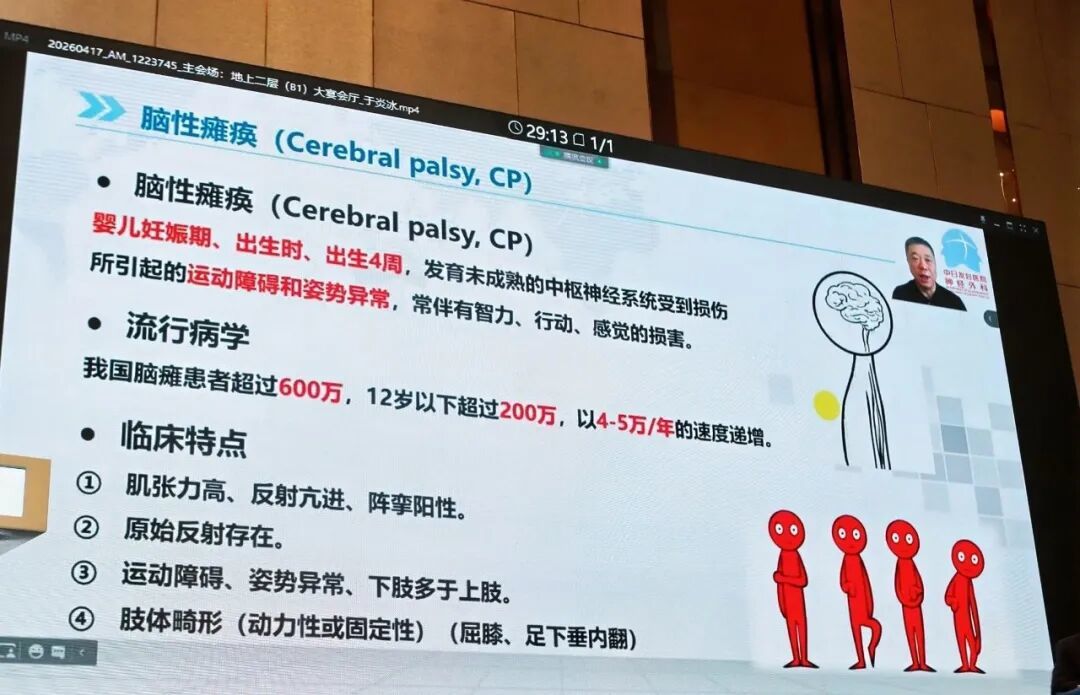 ↑在主会场全体大会学科前沿与进展上,中日友好医院于炎冰教授做学术报告《小儿脑瘫的治疗策略与展望》。