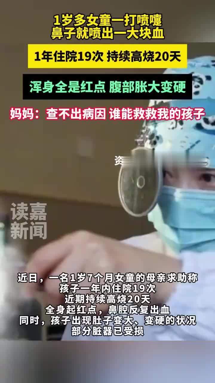 女童高烧20天鼻血止不住反复住院