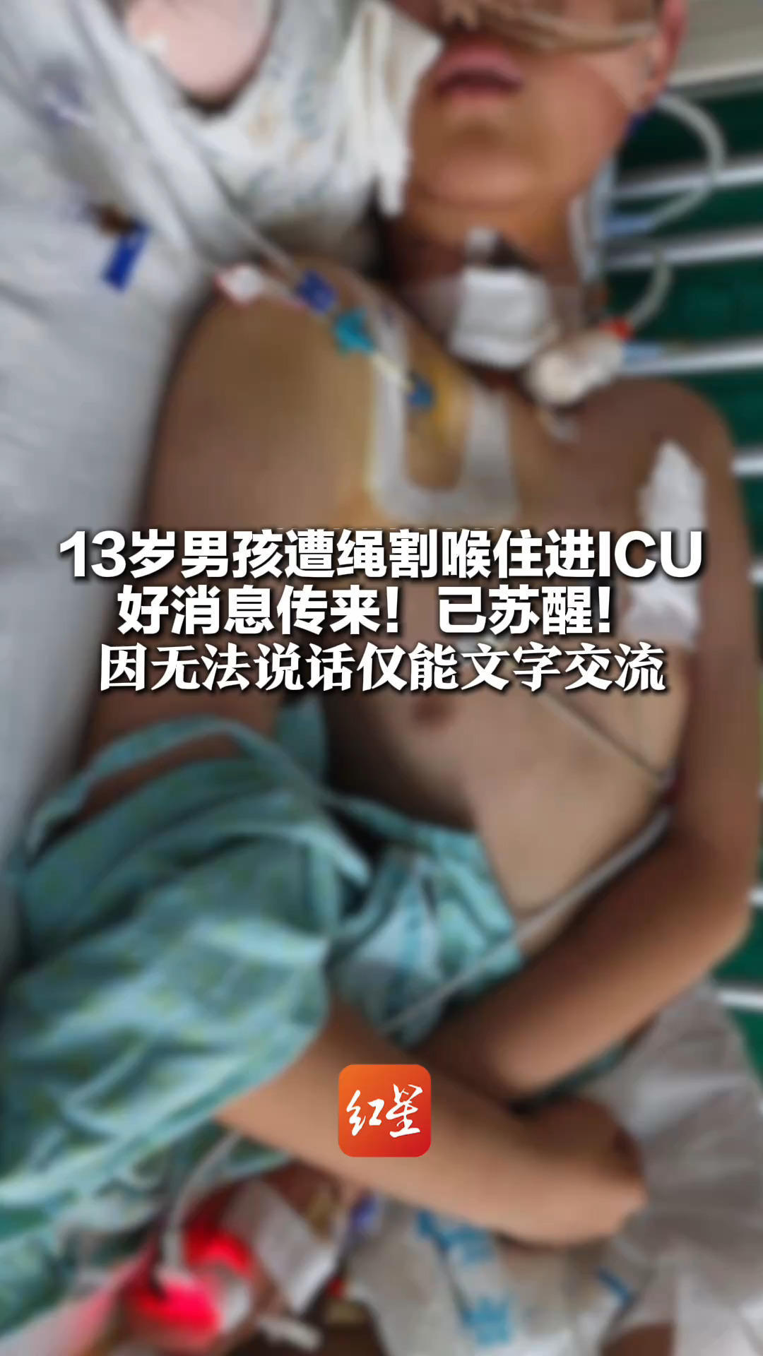 13岁男孩遭绳割喉住进ICU 好消息传来！已苏醒！因无法说话仅能文字交流 家属说他醒来后就问啥时候回家
