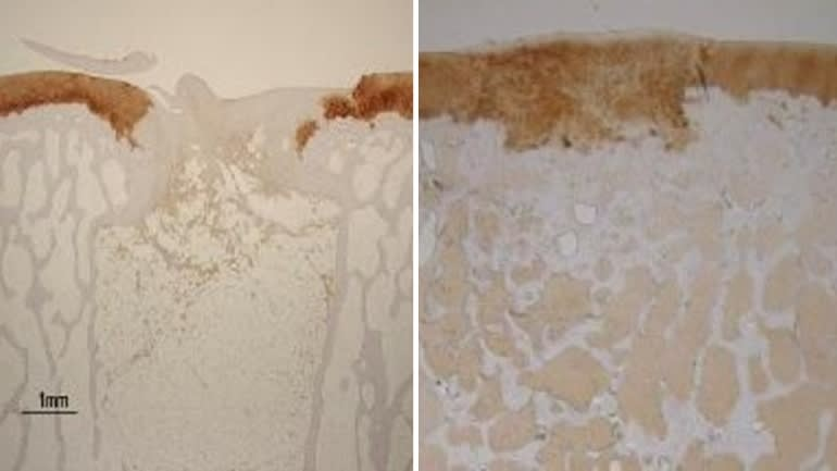 再生前后的膝关节软骨与骨骼