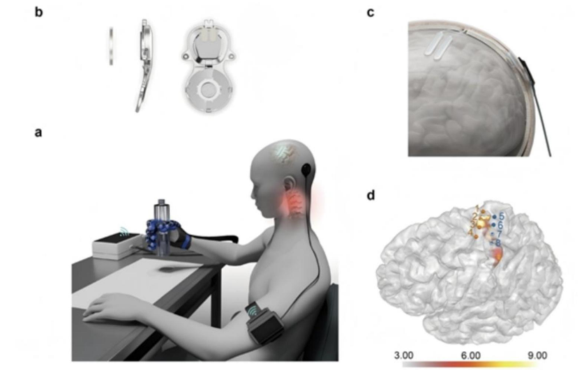 图：博睿康产品示意图，来源：德邦证券
