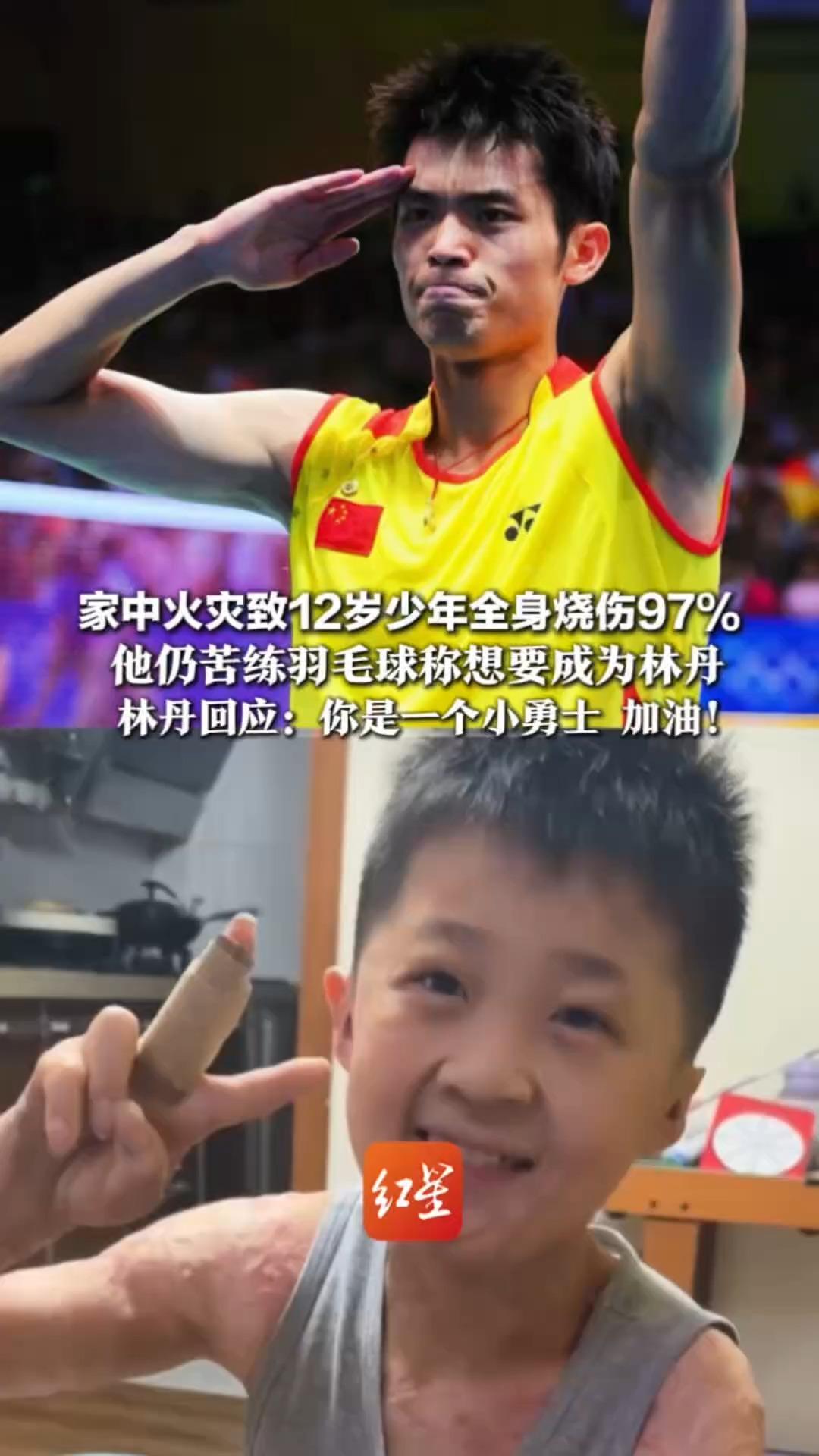 偶像的力量在此刻具象化了 家中火灾致12岁少年全身烧伤97% 他仍苦练羽毛球称想要成为林丹 林丹回应：你是一个小勇士 加油
