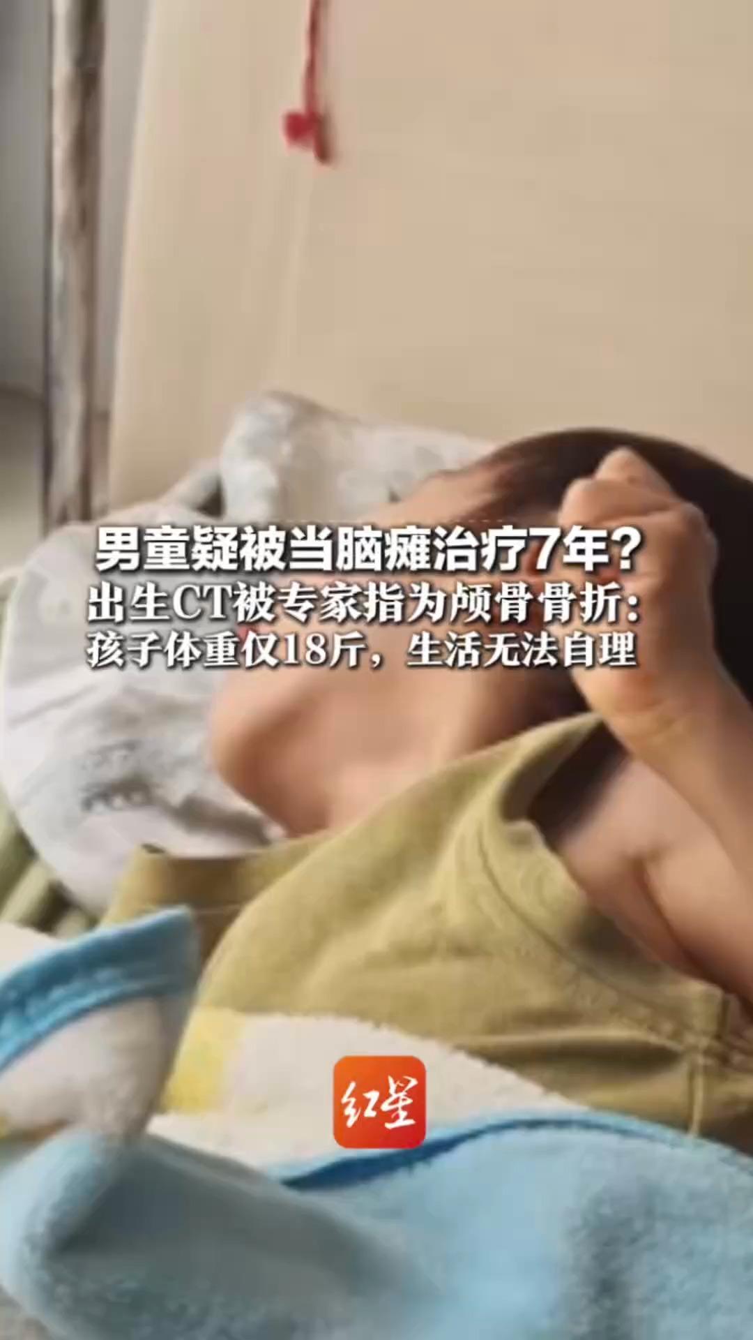 男童疑被当脑瘫治疗7年？出生CT被专家指为颅骨骨折：孩子体重仅18斤，生活无法自理 父母已起诉医院隐瞒真相