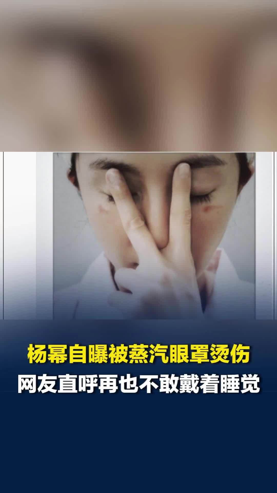 杨幂自曝被蒸汽眼罩烫伤！网友直呼后怕：每次都是戴着睡觉，再也不敢