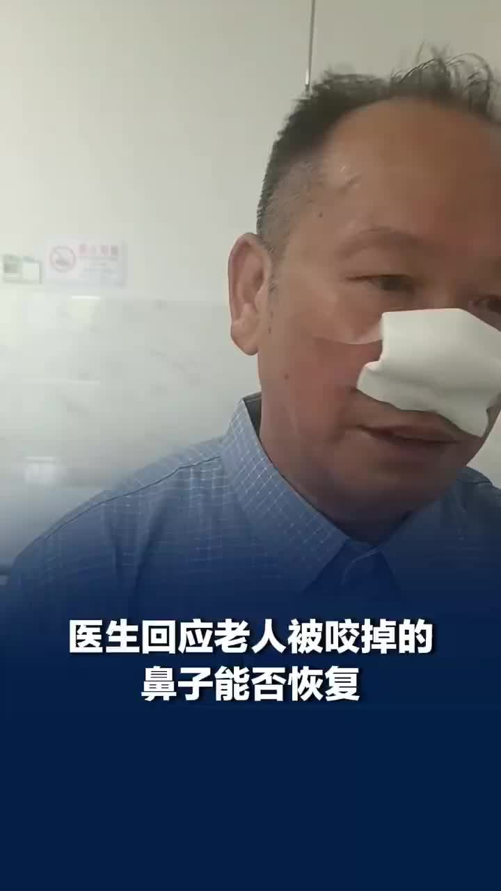医生称被歹徒咬掉鼻子老人无需人工鼻，被歹徒咬掉鼻子老人可恢复鼻外形，约是原来的80％
