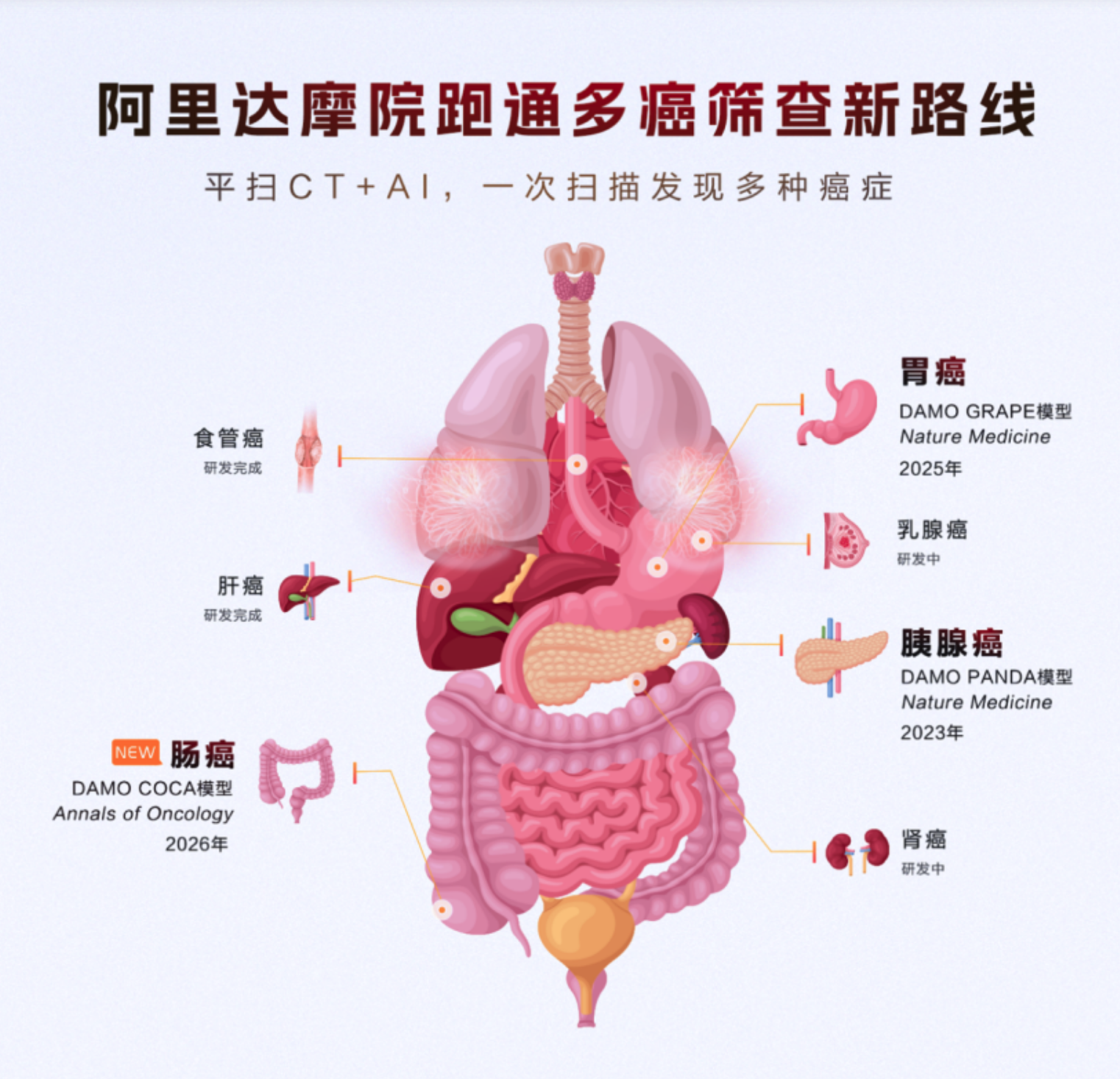 阿里发布第三个癌症AI模型：接连突破胰腺癌、胃癌、肠癌筛查难题
